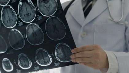 Brain Injuries